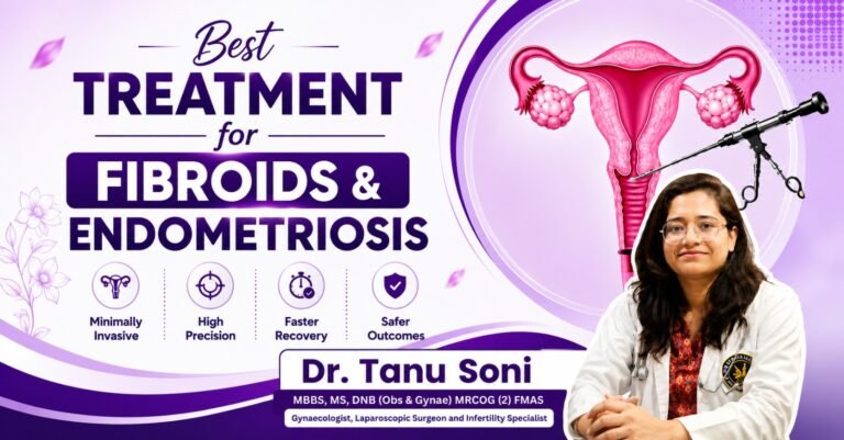 Best treatment for fibroids & endometrisios