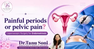 Laparoscopic Surgery for Endometriosis in Indore (M.P.)